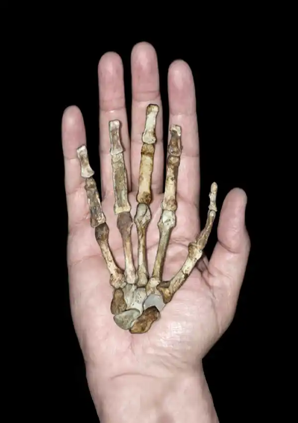 Human hand with the bones of human hand resting on top
